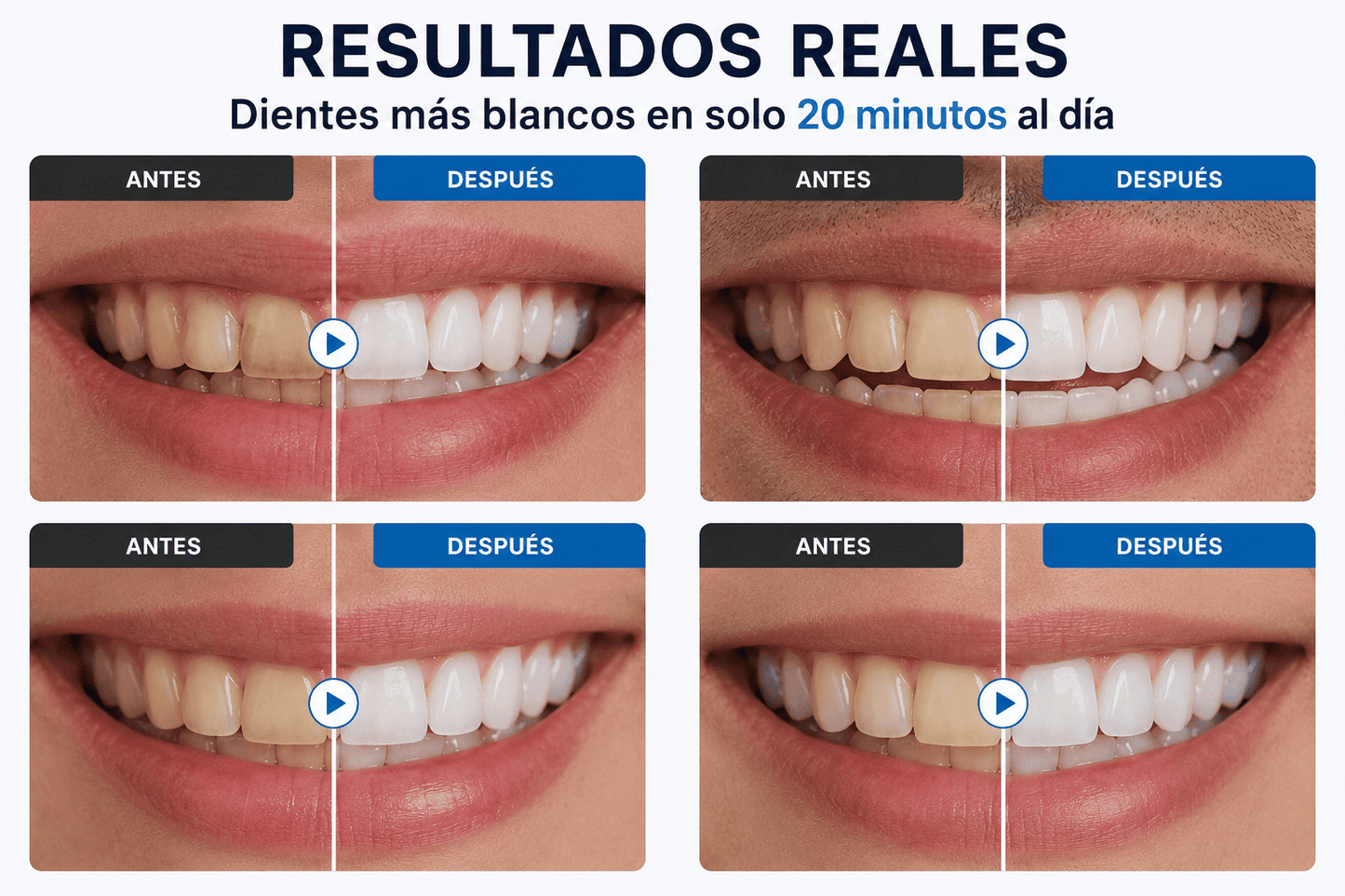 Kit Blanqueador Dental UV
