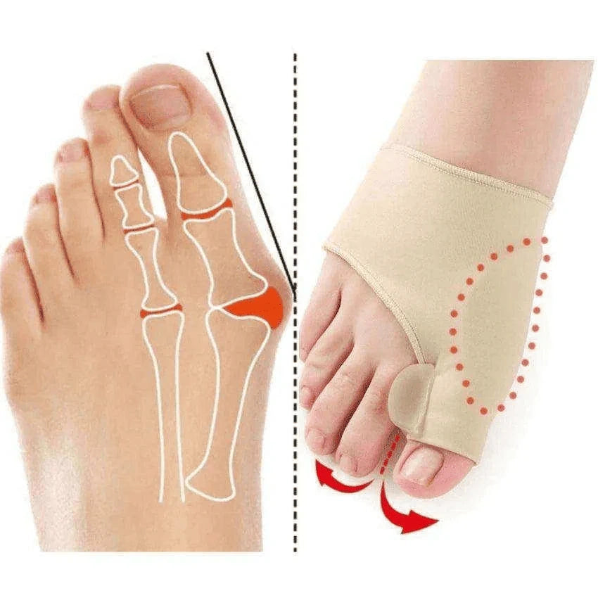 CORRECTOR DE JUANETES